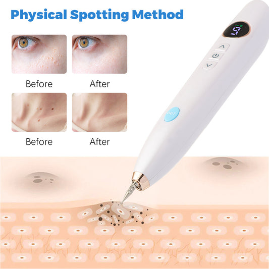 Laser Skin Mole Remove Plasma Pen