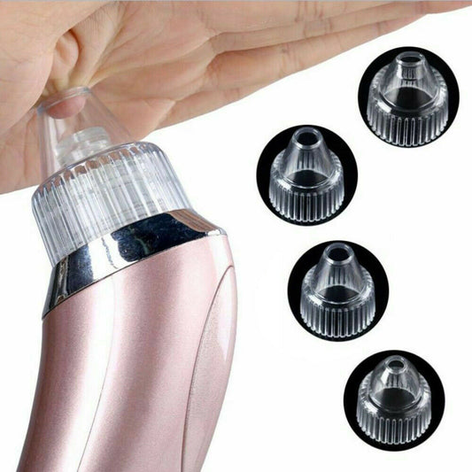 Electric Blackhead Vacuum