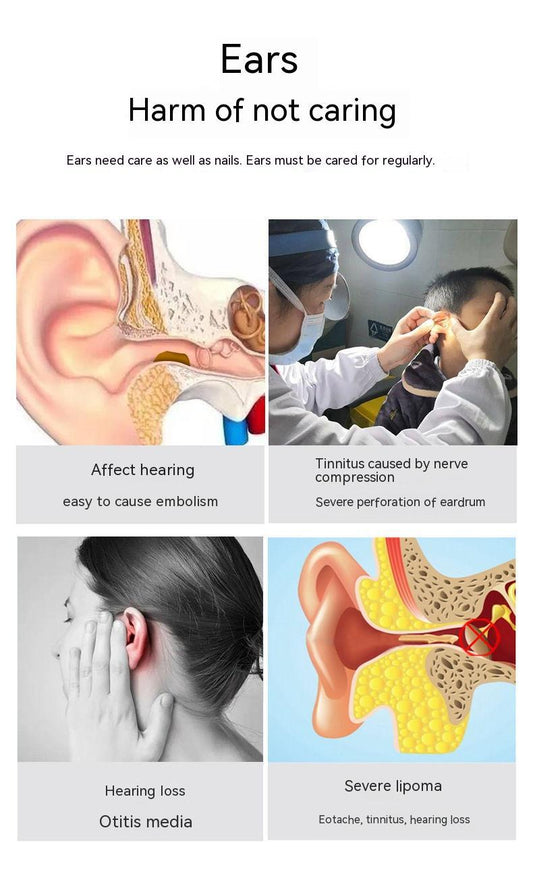 Wireless Smart HD Endoscope | Ear Picker