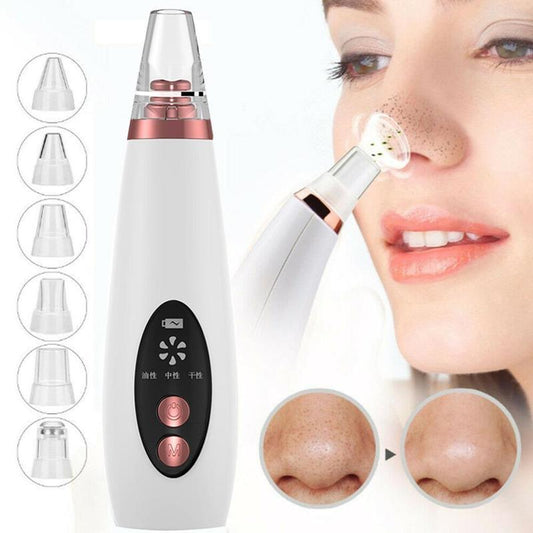Blackheads Remover & Acne Removal Tool